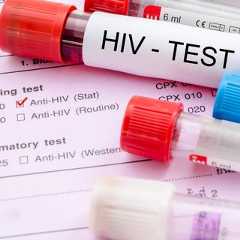 Les chercheurs du MIT travaillent sur un dispositif qui permettrait un dépistage plus simple et confidentiel du VIH ou du papillomavirus, des maladies pour lesquelles on n'arrive parfois pas à franchir la porte du laboratoire médical. © gamjai, Adobe Stock