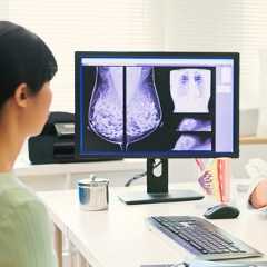 Ces chercheurs traquent les toutes premières heures d’un cancer du sein, avant même la tumeur. © PonyWang, iStock