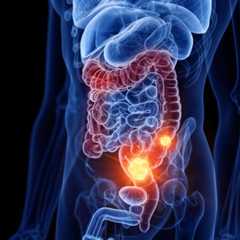 Le cancer du côlon est l'un des plus meurtriers en France.&nbsp;Ils affectent le plus souvent les personnes de plus de 50 ans, mais peut également survenir chez des personnes plus jeunes. © Sebastian Kaulitzki