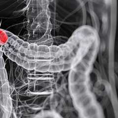 Le côlon représente la majeure partie du gros intestin, entre le cæcum et le rectum. © Sebastian Kaulitzki, Shutterstock