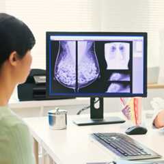 Ces chercheurs traquent les toutes premières heures d’un cancer du sein, avant même la tumeur. © PonyWang, iStock