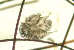 Image of Sarcoptes