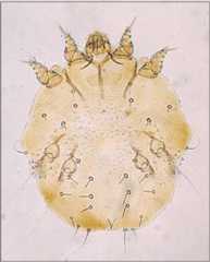Image of Sarcoptes