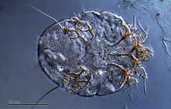 Image of Sarcoptes