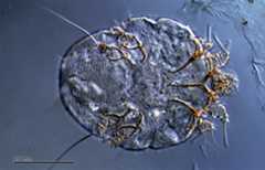 Image of Sarcoptes