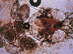 Image of Sarcoptes