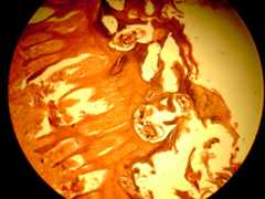 Image of Sarcoptes
