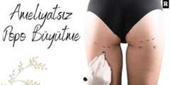 Ameliyatsız Popo Büyütme ile Daha Dolgun Kalçalar