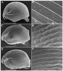 Alonella parthenogenetic females identified based on morphological characters.