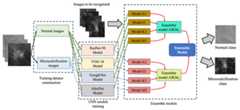 The development of final ensemble models for microcalcification identification.