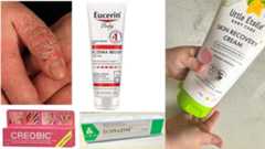 ubat gatal paling berkesan farmasi