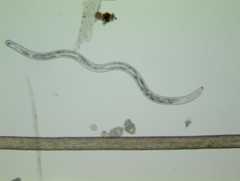 Size of a lance nematode (one of the largest plant-parasitic nematodes) compared to a human hair. 