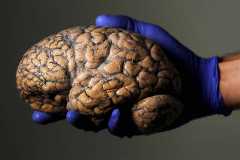 FILE PHOTO: A researcher holds a human brain in Duffel, Belgium