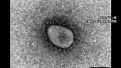 また新変異株「オミクロンXE」が出現 ステルスをさらに上回る感染力か…頼みのワクチン接種は若者の敬遠で進まず|FNNプライムオンライン