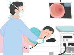 図２　分化型がんと未分化型がん