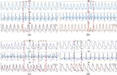 NABNet Performance Figure 2