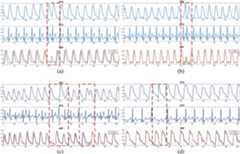 NABNet Performance Figure 2