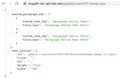 User Entity API JSON