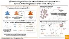 Visual Abstract on 'Spatial transcriptomics reveals a low extent of transcriptionally active hepatitis B virus integration in patients with HBsAg loss'