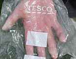 Shock: Nicholas Robertson who had his burnt hand enclosed inside a Tesco plastic bag by staff at the University Hospital in Cardiff