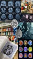 an image of brain images and mri images