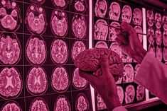 a person holding a stick in front of a brain scantropiction board with pink images on it