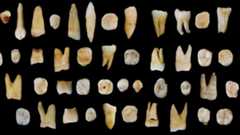 an array of human teeth from the cave site