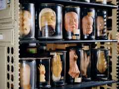 A Medical-History Museum Contends with Its Collection of Human Remains