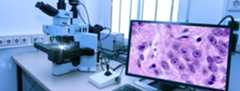 mikroskop og dataskjerm som viser en prøve av celler