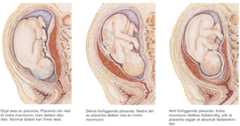 Placenta.