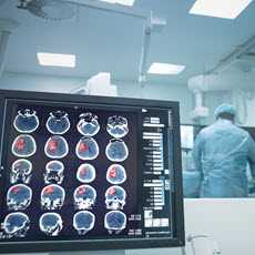 Brain Tumors