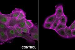 Immunofluorescence labeling and single-cell analysis of Src activity in normal breast epithelial cells found that the level of active Src was increased at low pH (left) and decreased at high pH (right) compared to control cells (center).