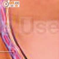 正常情況的精索