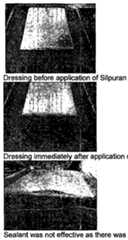 Figure imgf000078_0001