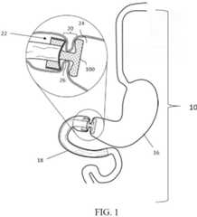 Figure P1020207031440