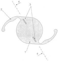 Figure 00000001