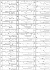 Figure imgf000032_0001