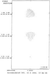 Figure imgf000099_0001