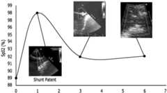 Figure imgf000033_0002