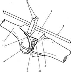 Figure GB2558543A_D0003