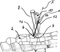 Figure DE102014219930A1_0001