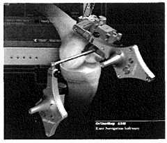 Figure imgf000010_0001