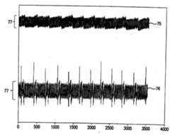 Figure R1020067007066