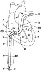 Figure DE102022111626A1_0000