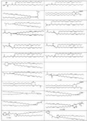 Figure imgf000039_0001