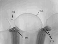 Figure GB2557119A_D0006