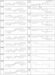 Figure imgf000059_0001