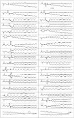 Figure BDA0002627493280000151