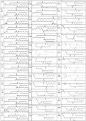 Figure imgf000029_0001