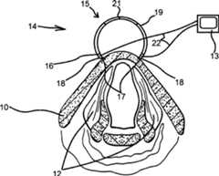 Figure DE102014113158A1_0001